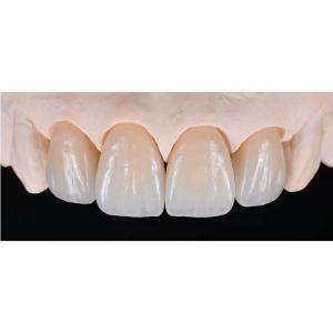 Zirconia